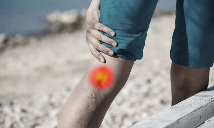 bol iza koljena